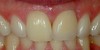 lovely-smile-dental-care-photo-gallery-after-02